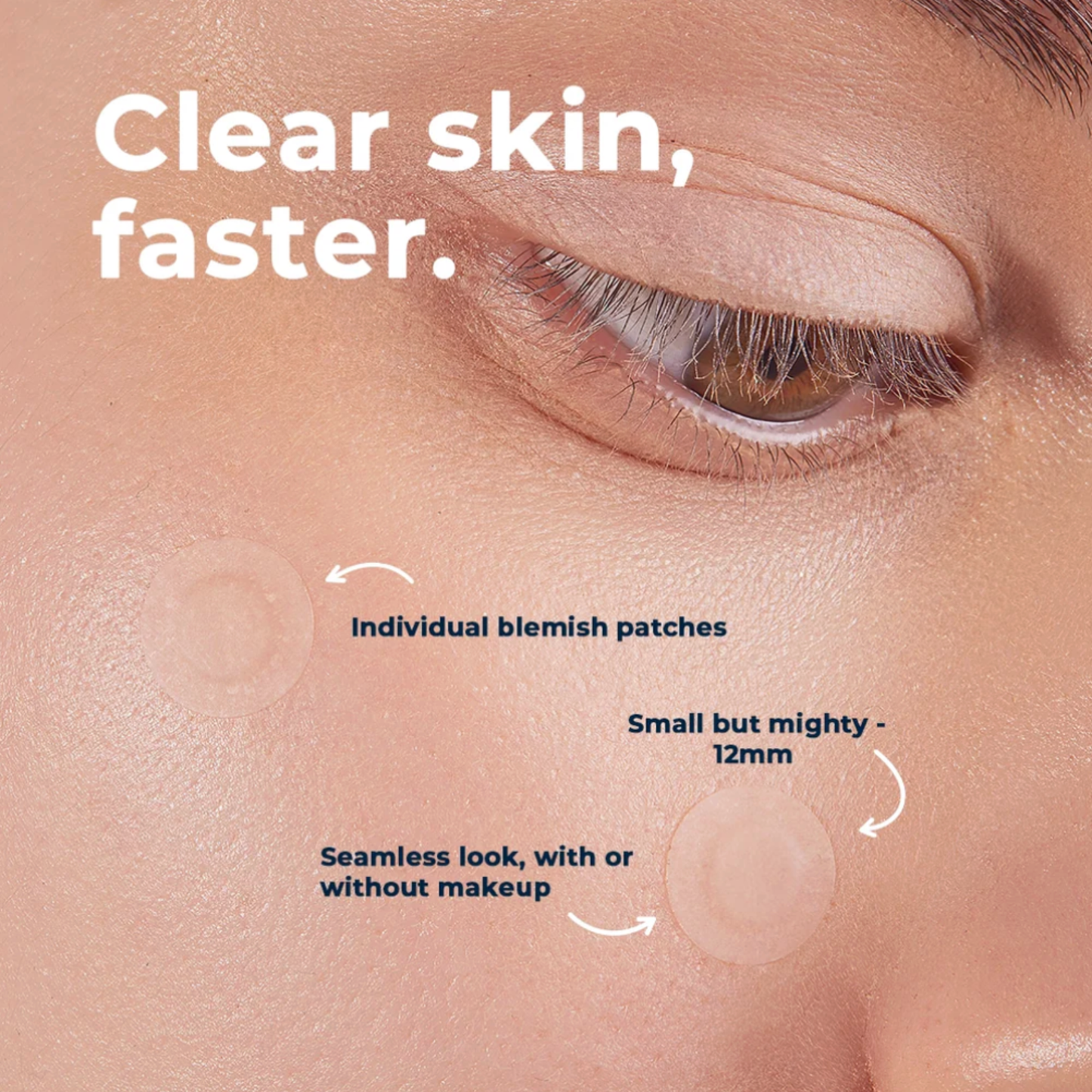 VitaMedica Clear Skin Spot Dots