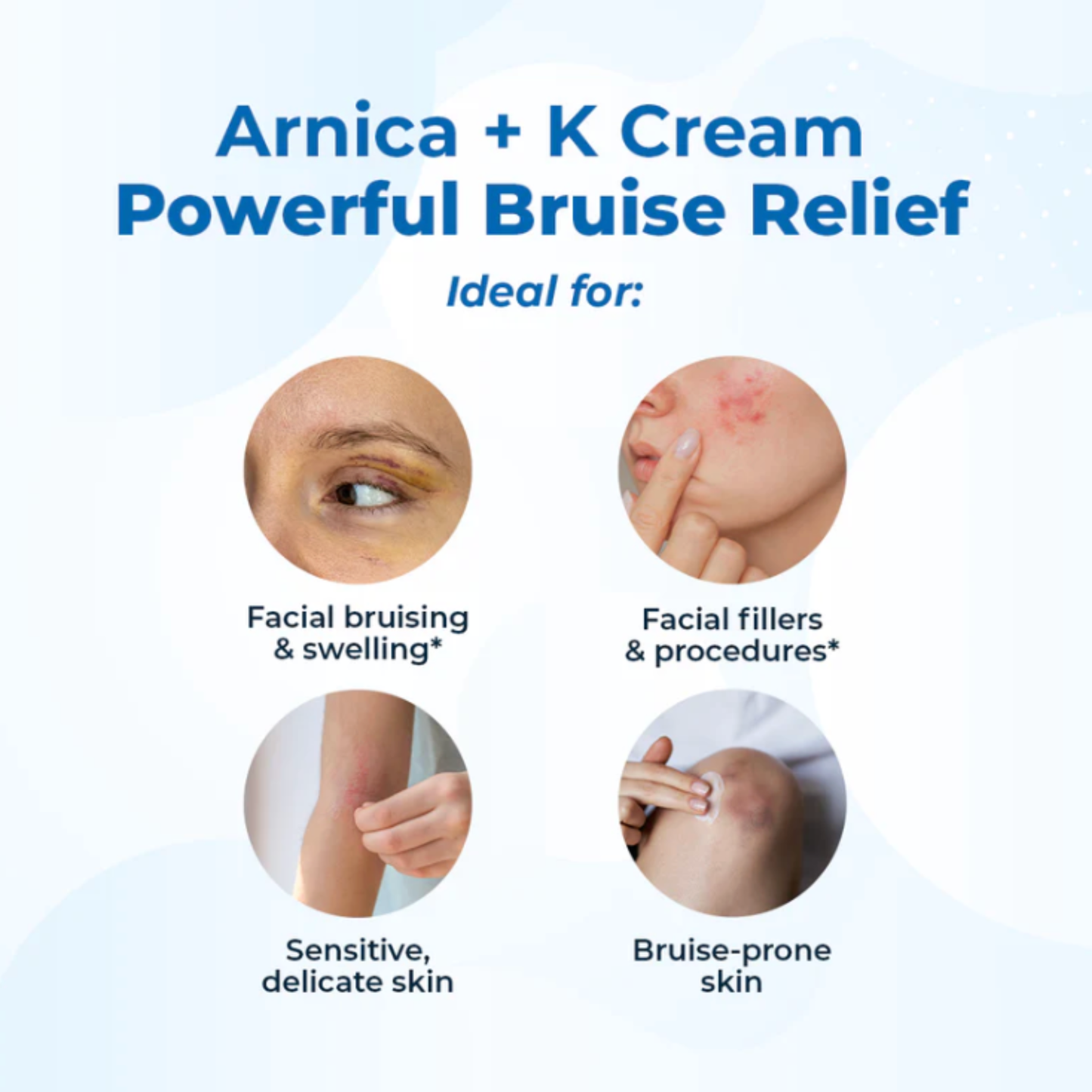 VitaMedica Arnica + K Cream 0.5oz