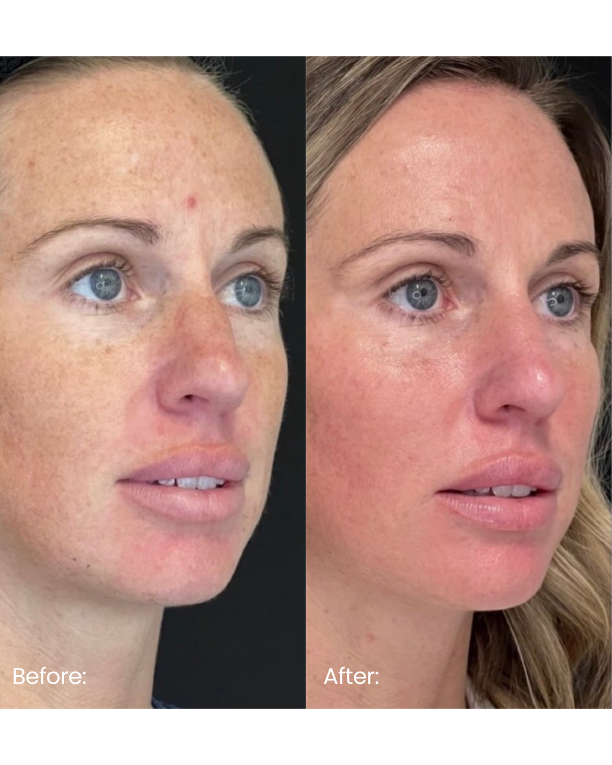 Skin + Facial Rejuvenation