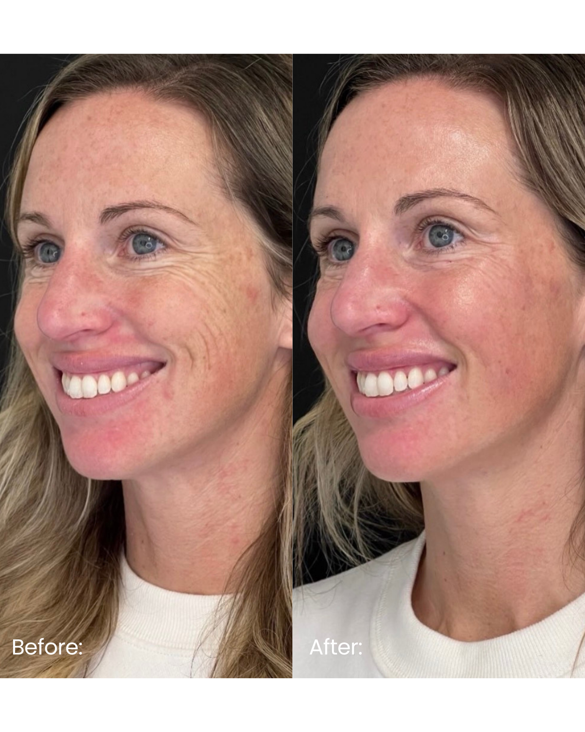 Skin + Facial Rejuvenation