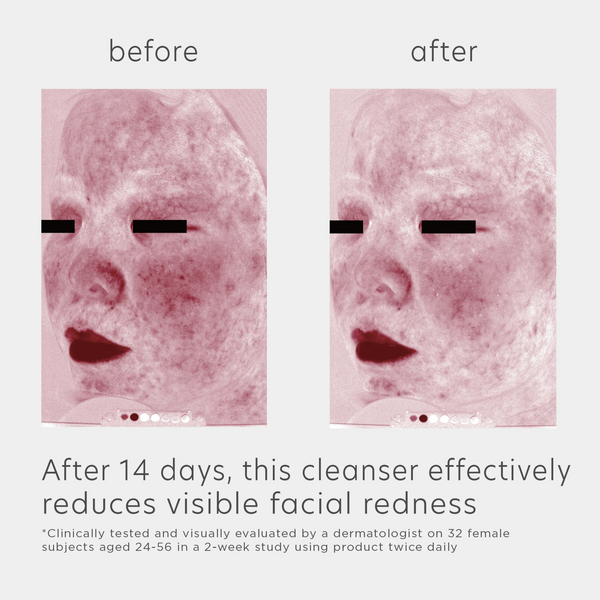 EltaMD Skin Recovery Amino Acid Foaming Cleanser